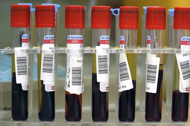 Раскрыта тайна появления алкоголя в крови насмерть сбитого «пьяного» мальчика