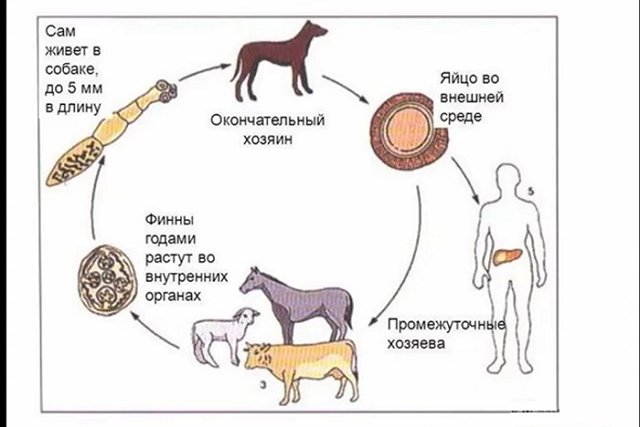 У россиянки в печени лопнула киста с паразитами