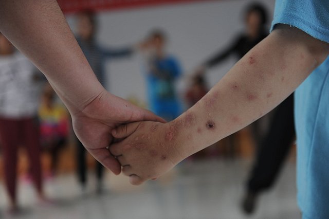 В интернат на Ляпустина назначили нового директора