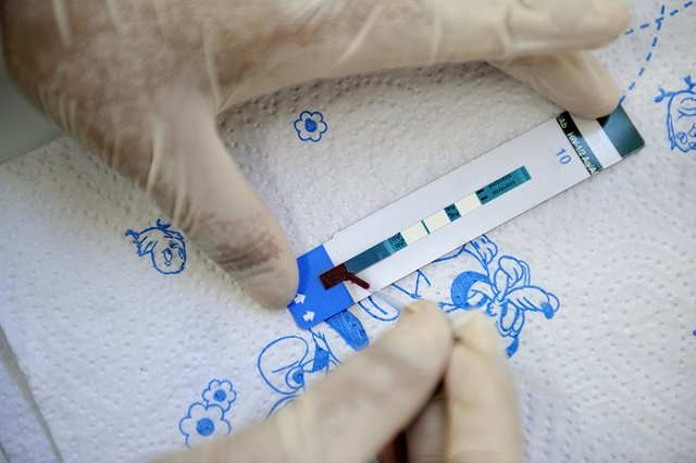 Семь необычных способов подхватить ВИЧ