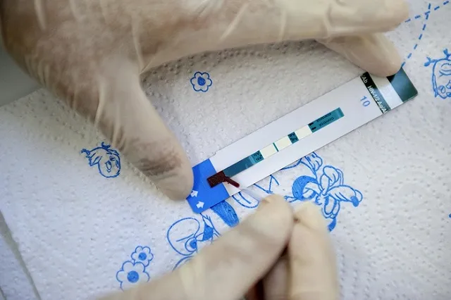 Семь необычных способов подхватить ВИЧ