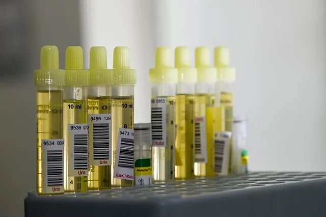 Отца виновника ДТП на Малышева вызвали в СКР