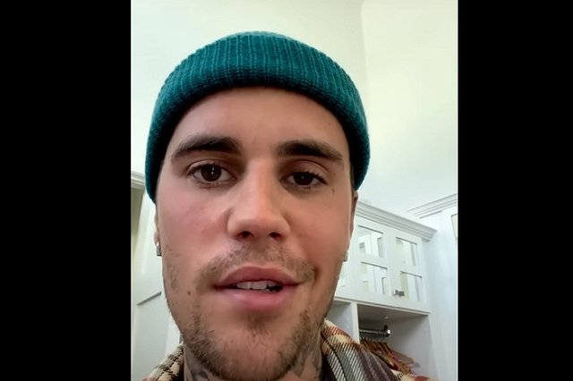 Певец Джастин Бибер заявил, что у него парализовало половину лица