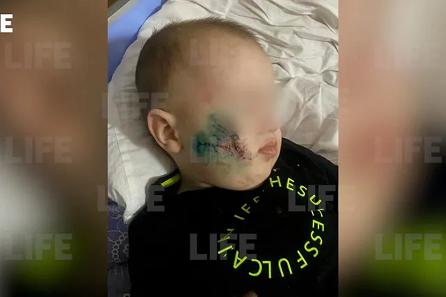 Стаффорд вцепился в лицо двухлетнему ребенку в Тюмени