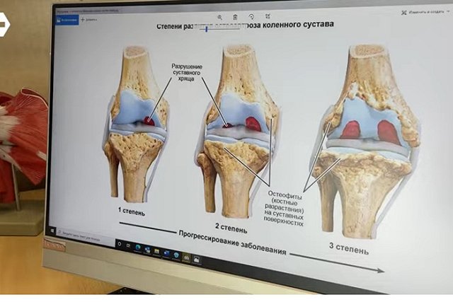 Ушедший на СВО добровольцем уралец переводится поближе к дому из-за заболевшей жены