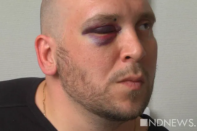 «Это любовный треугольник». Полиция разобралась в инциденте с другом Zergulio