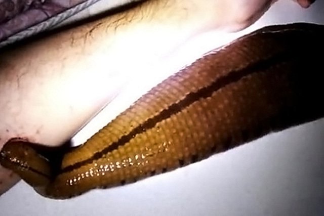 Пиявка размером с полруки заменила мужчине кота