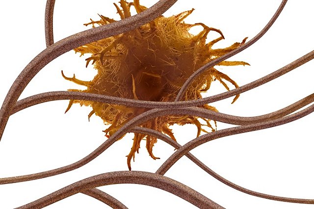 Назван главный способ уберечься от рака