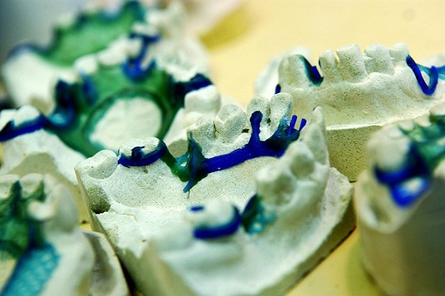 Губернатор обвинил в саморекламе жителей, засыпавших ямы слепками зубов