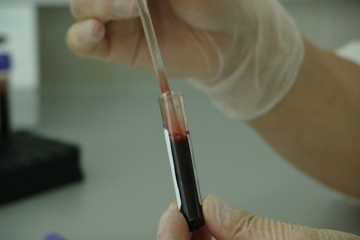 До 40% тестов на коронавирус показывают ложноотрицательный результат