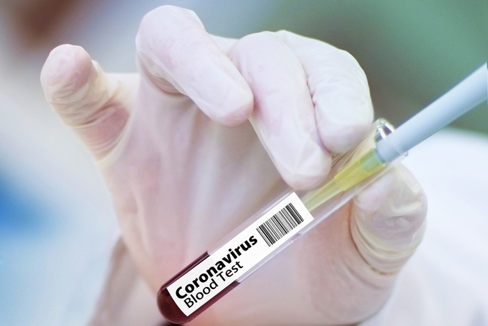 Российские ученые нашли новый способ лечения коронавируса