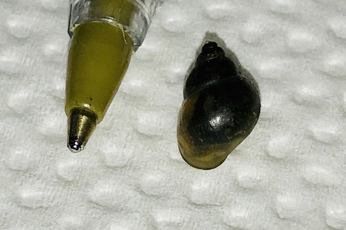 Тюменские медики обнаружили в ухе одного из пациентов живую улитку