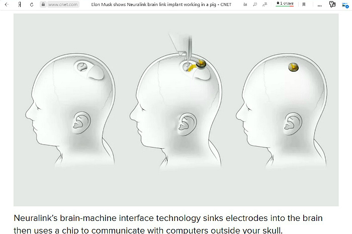 Маск рассказал, как будут вживлять чипы в черепа для подключения мозга к компьютеру