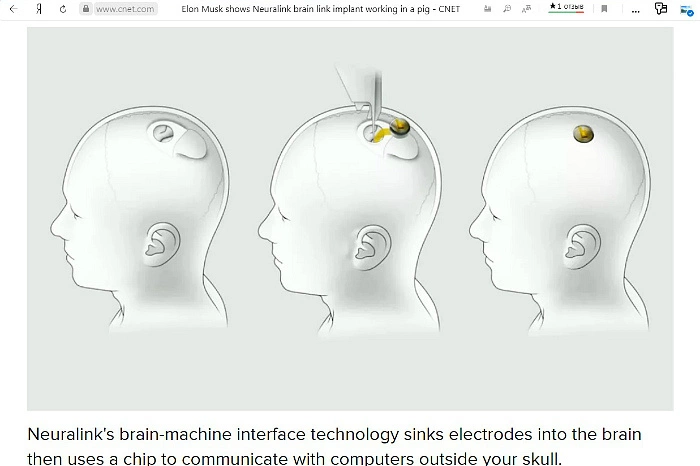 Маск рассказал, как будут вживлять чипы в черепа для подключения мозга к компьютеру