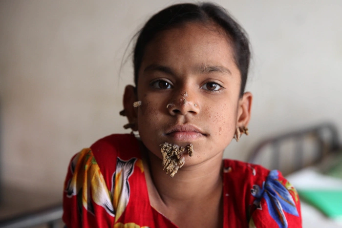 Лиза Пескова призналась, что над ней издевались из-за лица