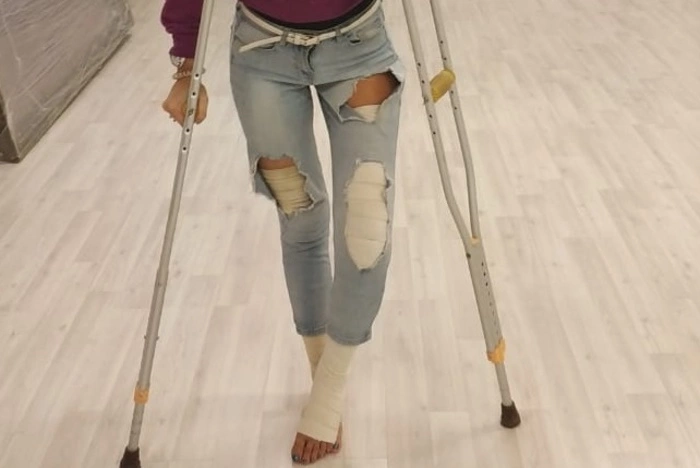 В Екатеринбурге 17-летний водитель сломал девушке-хореографу ноги