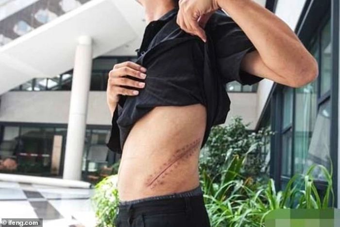 Молодой человек отдал почку за iPhone и остался инвалидом