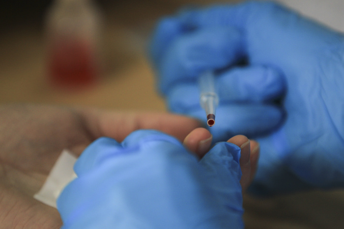 При сдаче экспресс-теста на ВИЧ в Екатеринбурге нашли инфицированного