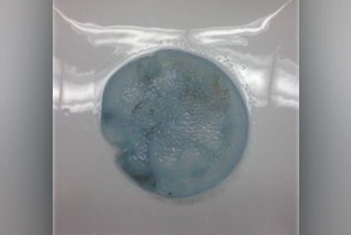 Австралиец принёс в полицию мёртвых медуз, решив, что это грудные импланты жертв