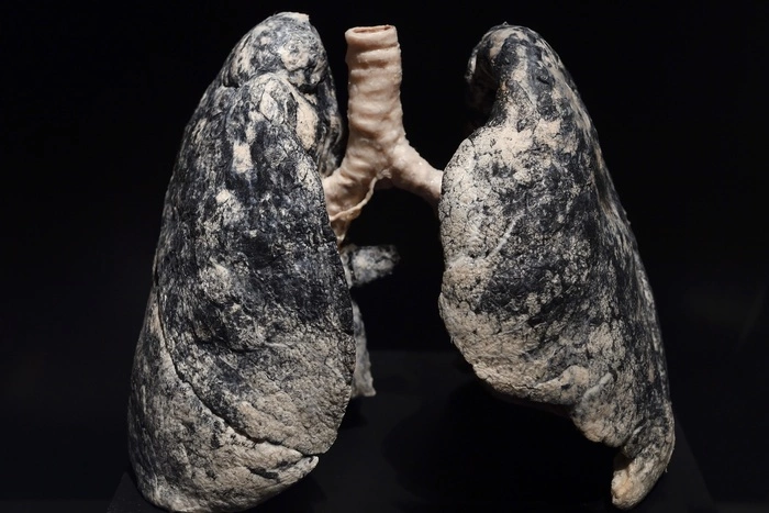 Ученые нашли продукты, восстанавливающие легкие курильщика