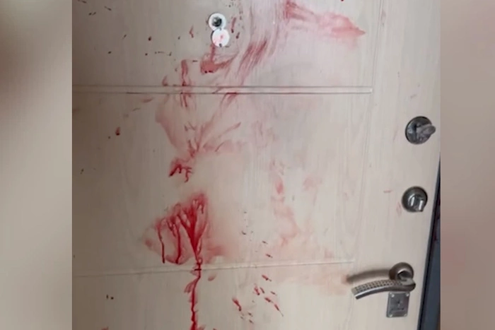 Екатеринбуржец разбудил друга, ударив ножом по спине