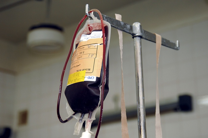 Жители Екатеринбурга смогут бесплатно пройти проверку на свертываемость крови