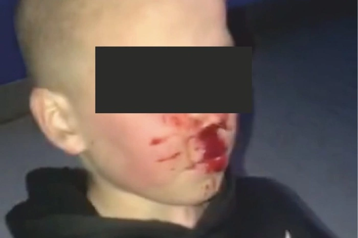 В Каменске-Уральском подростки жестоко избили 12-летнего мальчика