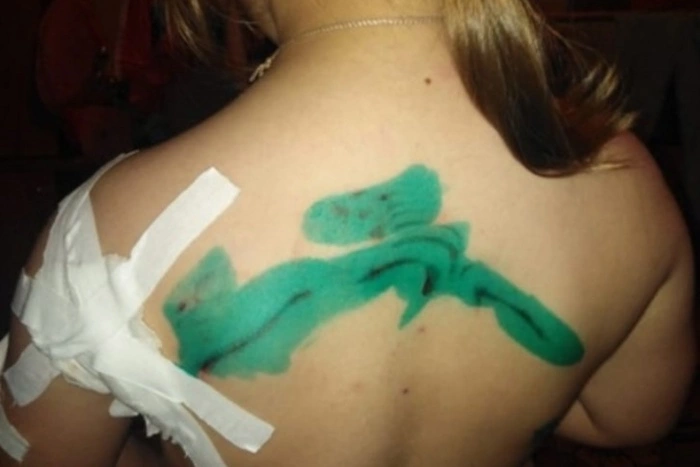 «Чуть не разорвали»: на Урале бездомные собаки напали на 5-летнюю девочку