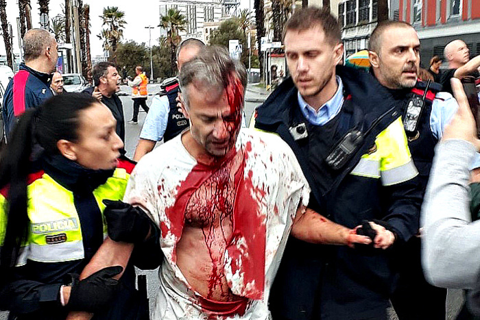 Стрельба по каталонцам: полицейские ранили 38 человек