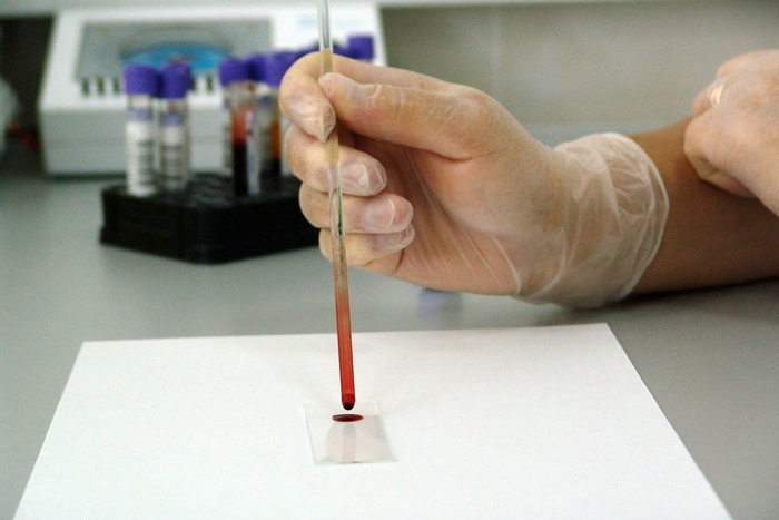 Российский онколог сообщил, как выявить рак по анализу крови