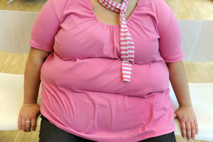 Минздрав назвал страдающие от ожирения регионы