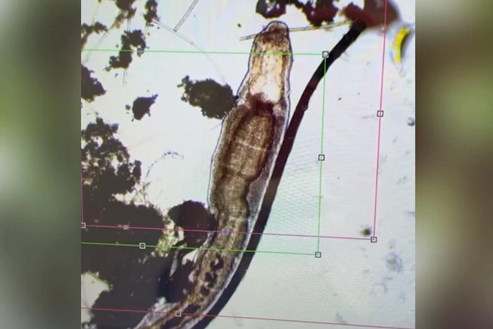 Врач из Екатеринбурга изучила воду из Исети и пришла в ужас