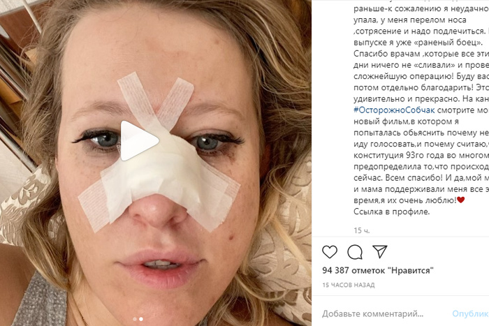 Ксения Собчак сломала нос, неудачно упав, по ее словам