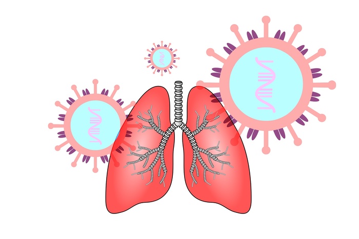 «Нет кашля, отдышки и лихорадки», — Минздрав заявил о бессимптомном развитии пневмонии при COVID-19
