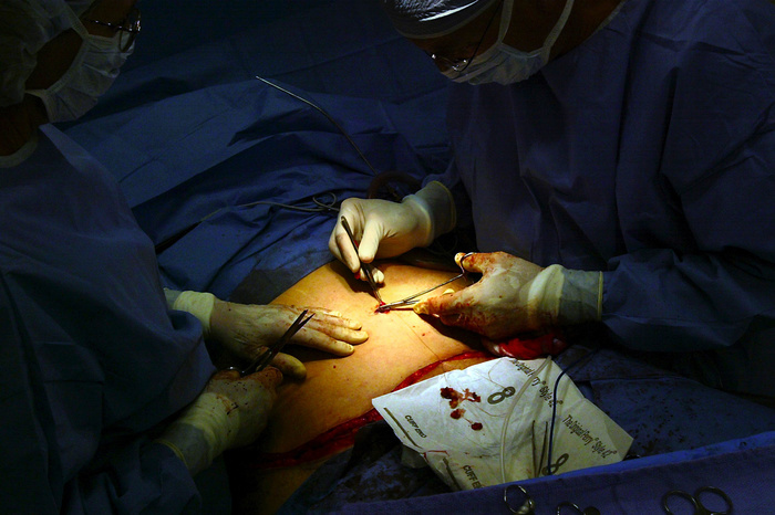 СКР начал проверку екатеринбургского центра пластической хирургии