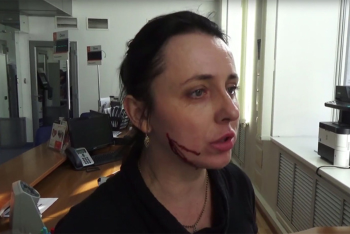 Жительнице Воронежа в банке проткнули щеку шариковой ручкой