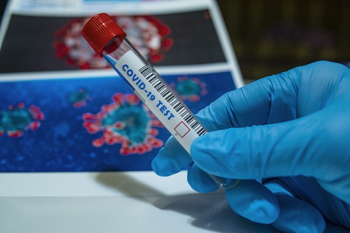 За прошедшие сутки медики проверили на коронавирус шесть тысяч уральцев
