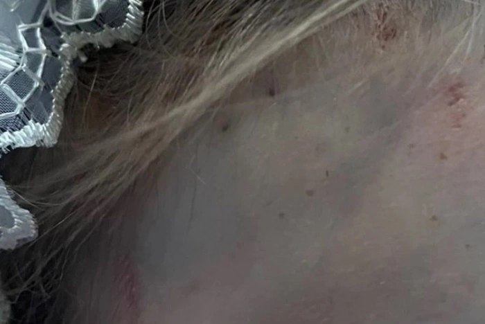 «Малахов» озвучил новую версию гибели 16-летней школьницы в Каменске-Уральском