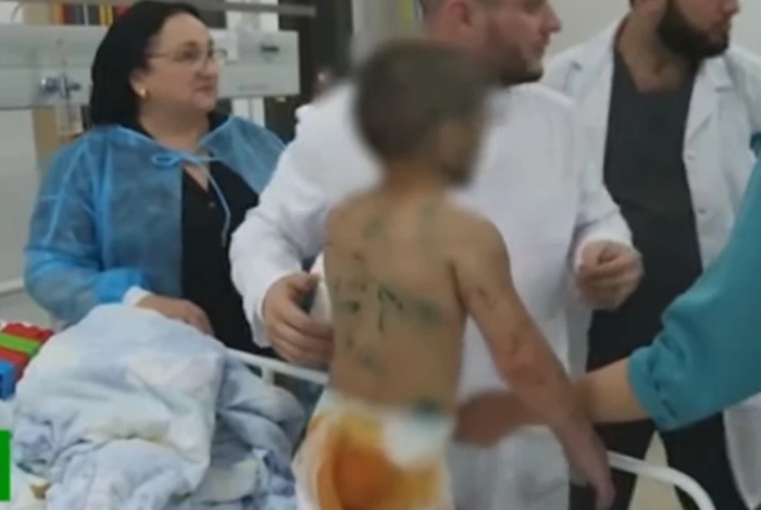 Девочке, избитой тетей в Ингушетии, ампутировали руку