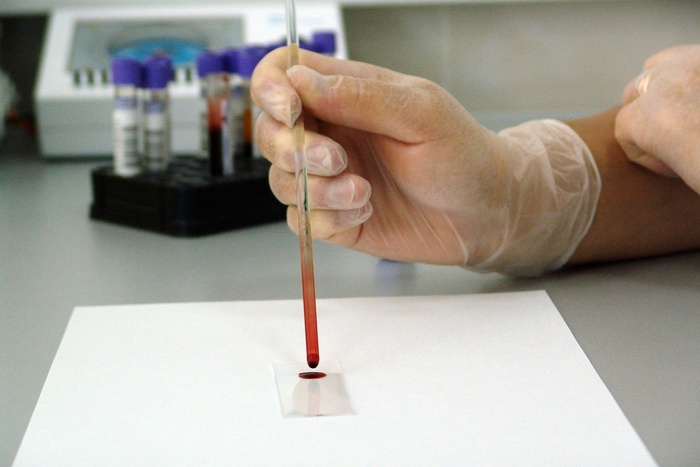 В Екатеринбург из Китая привезли десятки тысяч тестов на антитела к коронавирусу