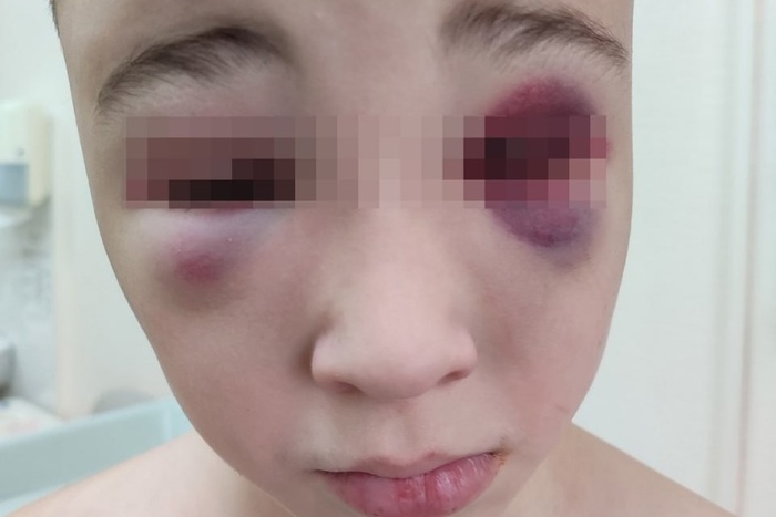 Россиянка обвинила участника спецоперации в избиении 10-летнего сына палками