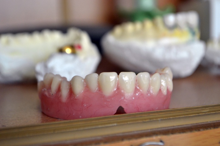 Стоматология выплатит тюменке более 230 тыс. рублей за пять удаленных зубов