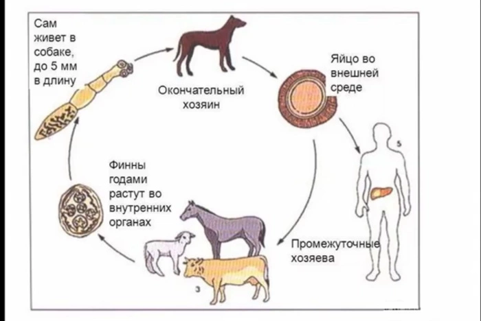 У россиянки в печени лопнула киста с паразитами