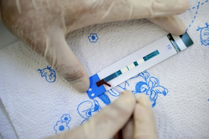 Семь необычных способов подхватить ВИЧ