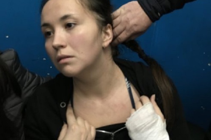 Жительница Екатеринбурга утверждает, что ее избили полицейские