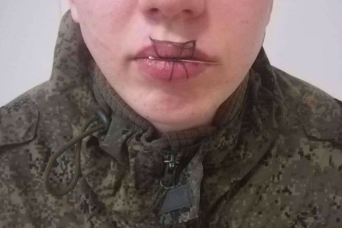 На Урале солдат зашил себе рот после ссоры с девушкой
