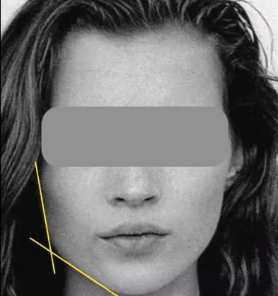 Ученые установили идеальную форму челюсти, при которой человек считается красивым