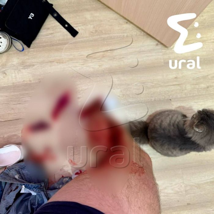 От госпитализации пострадавший отказался, рассказала Е1.RU знакомая. Фото: Telegram-канал Ural Mash
