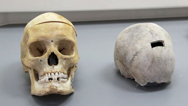 Профессия: судмедэксперт